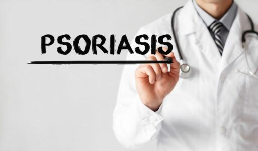 Psoriasis a skin condition causing itching, flaky skin